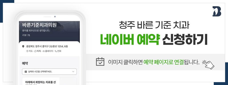청주충치치료잘하는곳